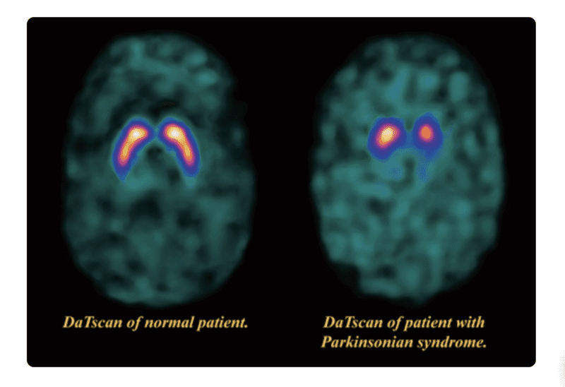 say that again..Sorting out the fallout following a significant misdiagnosis